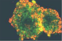 löydetyt Bacillus amyloliquefaciens ja muutamat muut bacillus lajit