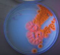 MH34 Aspergillus Asp.