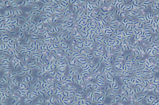 Kuva 34.Valomikroskooppikuvat kasvullisista (yläpaneli) ja itiöityneestä (alapaneli), kereulidia tuottavasta Bacillus cereus bakteerista.