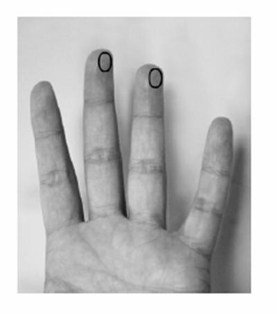 Testiliuskalla humaania tromboplastiinia ja peptidisubstraattia. 2. Lisätään näyte 3.