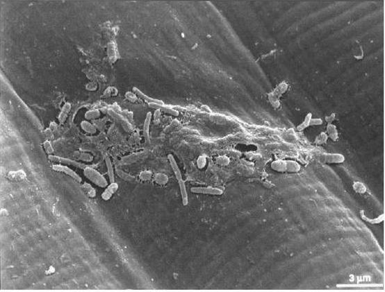5 Kuva 3. Pseudomonas aeruginosa -bakteerin muodostama biofilmi. Gramnegatiiviset sauvat ovat muodostaneet polysakkarideista koostuvan suojakerroksen [5, s. 269].