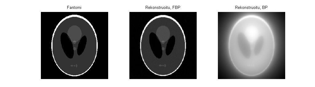 Kuva 2. Röngentomografian simuloinnissa käytetty fantomi ja rekonstruoidut kuvat 4.2 Fluoresenssitomografian simulointi Fluoresenssitomografian simulointi oli tämän projektityön varsinainen päämäärä.