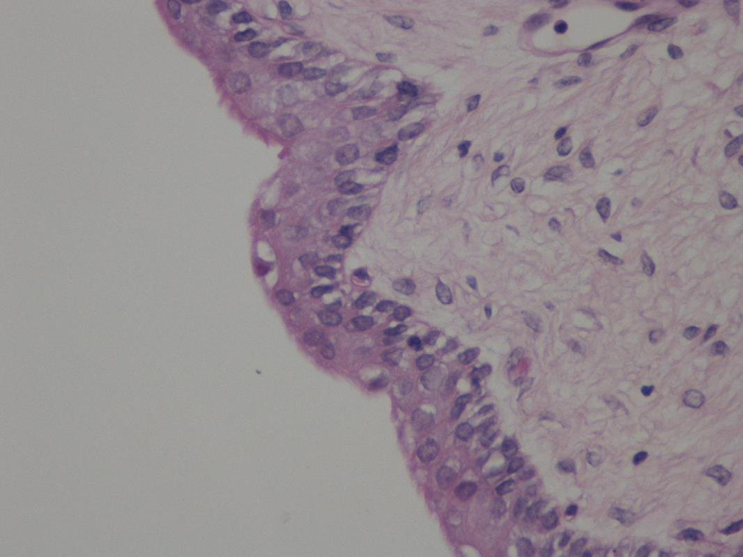 10 Kuva 2. Histologinen näyte uroteelistä. Miehillä virtsaputki on noin 12-20 cm pitkä, sillä se jatkuu peniksen päähän asti terskan alueelle, jonka päässä on virtsaputken ulkosuu.