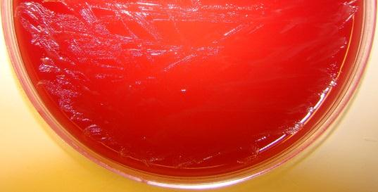 (Streptococcus anginosus) 2.
