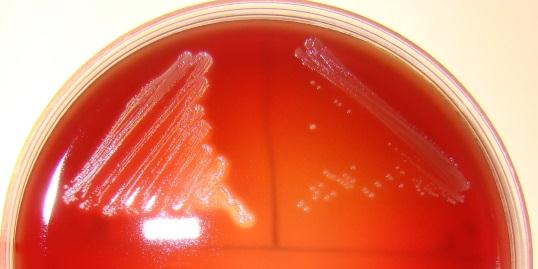 (Enterococcus casseliflavus). 3.