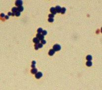 Peptostreptococcus anaerobius