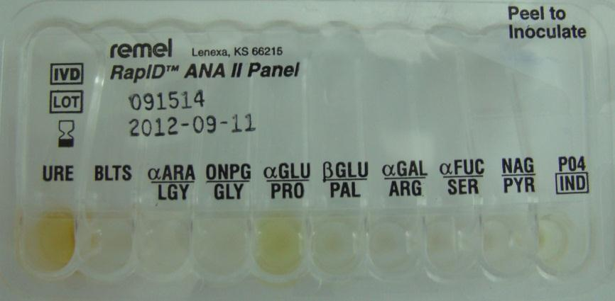 Näyte 34/2015 (8/2012). 3. Peptostreptococcus anaerobius 1.