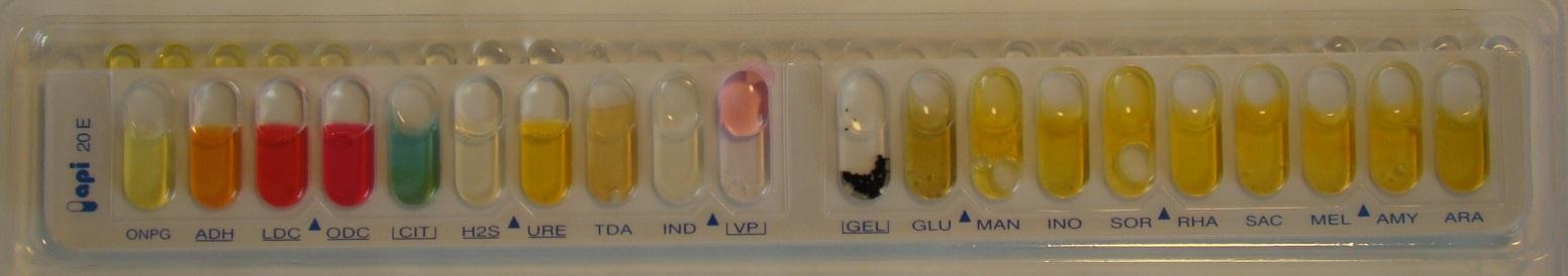 Näyte 23/2015 (3/2013) 2. Enterobacter aerogenes 1. API20E 5305773 Enterobacter aerogenes (96%).