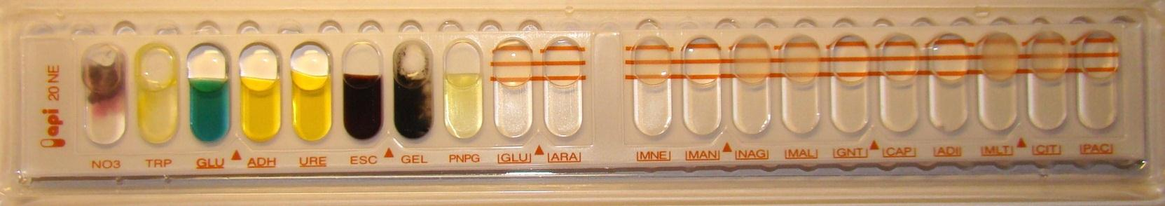 Näyte 23/2015 (10/2011) Stenotrophomonas maltophilia 1.