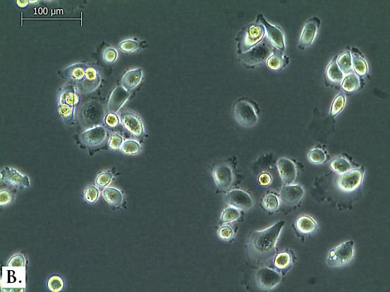 PC-3-linjan solut ovat kooltaan keskisuuria ja muodoltaan monikulmaisia. Ne muodostavat keskenään rypälemäisiä kasvustoja (kts. kuvio 3). Joissakin soluissa voidaan nähdä lipidi-inkluusioita.