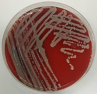 13 KUVA 1. Hajotusviljelmä (Kuva: Heidi Ikäläinen & Jonna Sääskö 2016) MRSA-näyte otetaan yleensä nenästä, nielusta ja mahdollisista infektioalueista, esimerkiksi haavoista.