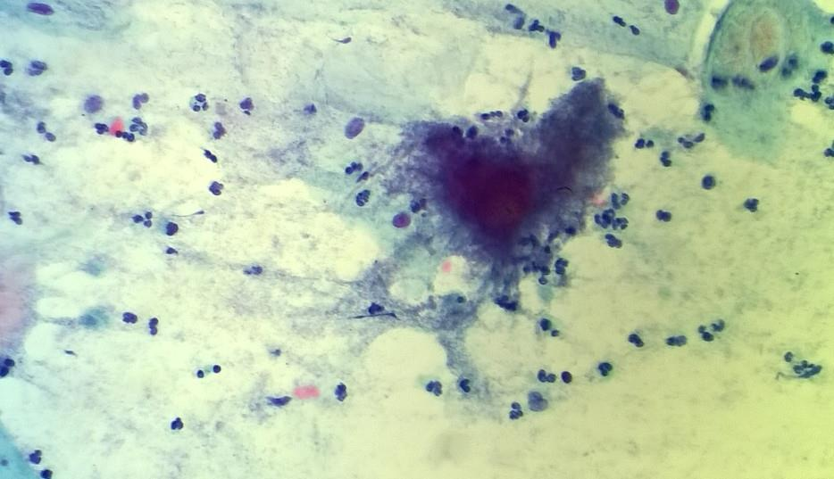 14 Actinomyces (Savikko Räbinä 2016). 5.5.5 Trichomonas vaginalis Trichomonas vaginalis (kuvio 5) on ihmisen sukupuolielimissä elävä siimaeläimiin kuuluva parasiitti.