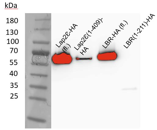 22 (37) 5.3 Proteiinien ilmenemistason määritys Ilmenemistason määrityksellä selvitettiin NIH/3T3-solujen kyky tuottaa tutkittavien proteiinien täyspitkiä sekä muokattuja muotoja.