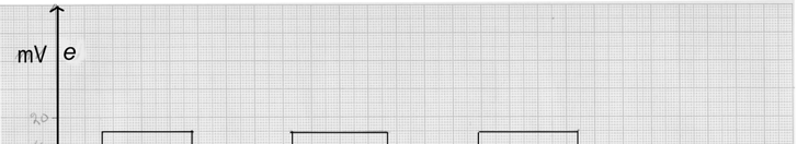 7. a) Paristot on kytketty sarjaan. Ylin paristo on toisin päin kuin uut. Jänniteittarin lukea on U = U + U U 3 =, 5 V +,5 V,5 V =,5 V.