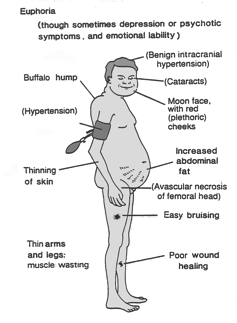 Astman pahentuminen ( aspirin-induced asthma ) psyyken muutokset harmaakaihi katabolia (iho, verisuonet, lihakset, luu) hyperglykemia hypertensio rasvakudos infektioalttius stressin sieto lasten