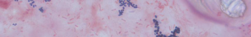 Staphylococcus aureus. 3.
