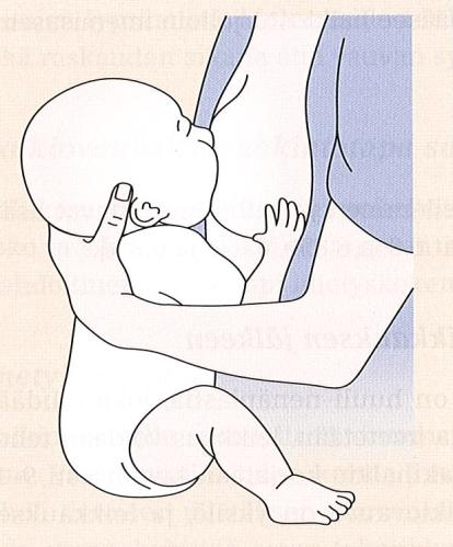 25 nielemistä. (Elfving-Little & Paaso 1998, 70; TAYS 2011.) Vauva voi esimerkiksi ikään kuin istuu äidin sylissä jalat eteenpäin tuettuina (kuva 3).
