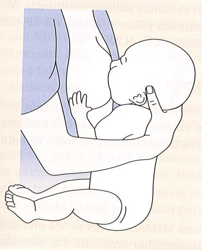 Suulakihalkiovauvoille saattaa sen sijaan sopia esimerkiksi asento, jossa vauva istuu myös äidin sylissä, mutta jalat tuetaan sivuun äidin selkään päin (kuva 3), kuten kainaloimetyksessä.