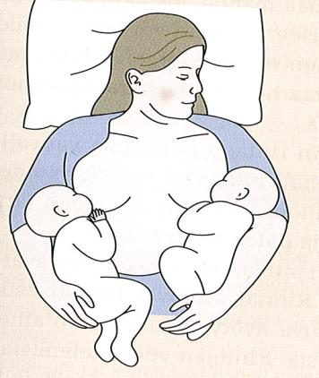 Mikäli toisen vauvan imemisrefleksi on heikompi kuin toisen, vuorottelulla varmistetaan myös molempien rintojen riittävä stimulaatio maidonerityksen ylläpitämiseksi.