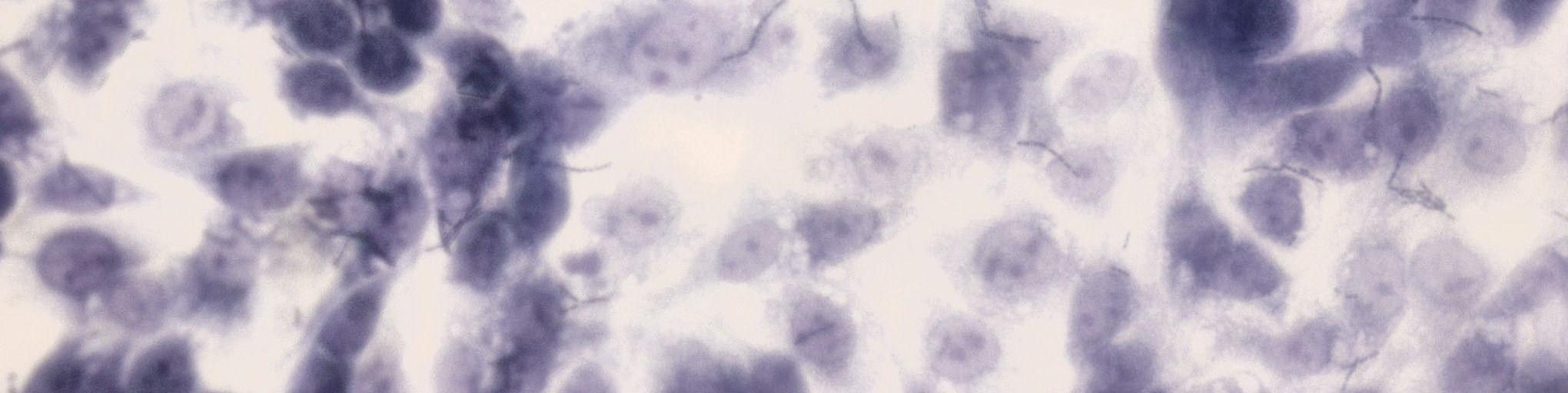 FITC:llä leimattuja soluseiniä sitoutui IPEC-1-soluihin vain muutamia yksittäisiä tai korkeintaan kymmeniä kappaleita kenttää kohden, kuten