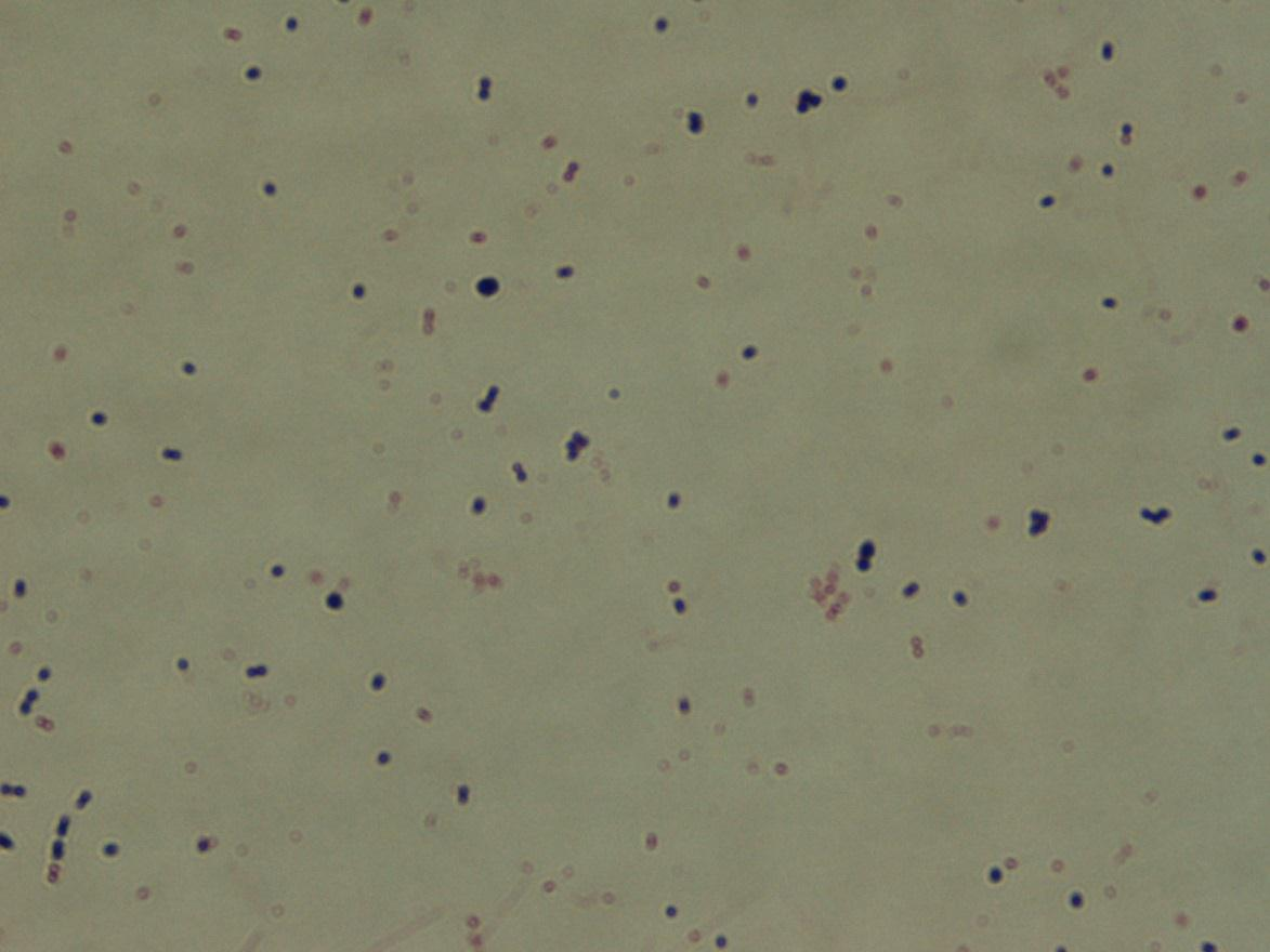 9 KUVA 5. Streptococcus pneumoniae gramvärjättynä. Työskenneltäessä mikrobiologian laboratoriossa täytyy työntekijän aina ottaa työturvallisuuden periaatteet huomioon.