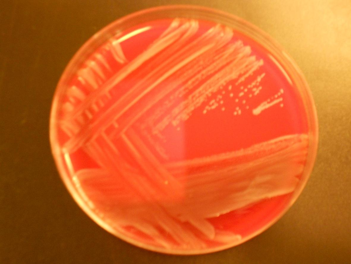 12 cus ja Staphylococcus haemolyticus. S. epidermis esiintyy iholla ja limakalvoilla ja sen osuus normaaliflooran stafylokokeista on 65 90 %. Koagulaasinegatiiviset stafylokokit ovat, S.