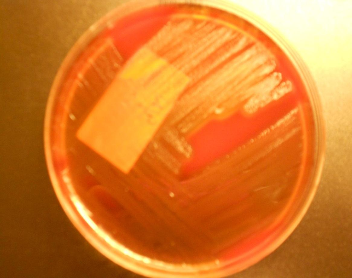14 KUVA 8. A-ryhmän streptokokki (Streptococcus pyogenes)- kasvustoa streptokokkimaljalla. 4.1.4 B-ryhmän streptokokki B-ryhmän beetahemolyyttinen streptokokki eli Streptococcus agalactiae kuuluu emättimen ja alemman suoliston normaaliflooraan.