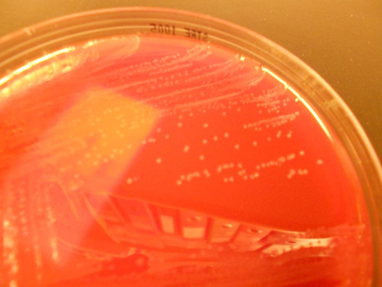 15 KUVA 9. B-ryhmän streptokokki (Streptococcus agalactiae)-kasvustoa streptokokkimaljalla. 4.1.5 Muut streptokokit Suuripesäkkeiset ja beetahemolyyttiset C- ja G-streptokokit kuuluvat normaalimikrobistoon hengitysteissä, ruuansulatuskanavassa ja urogenitaalialueella.