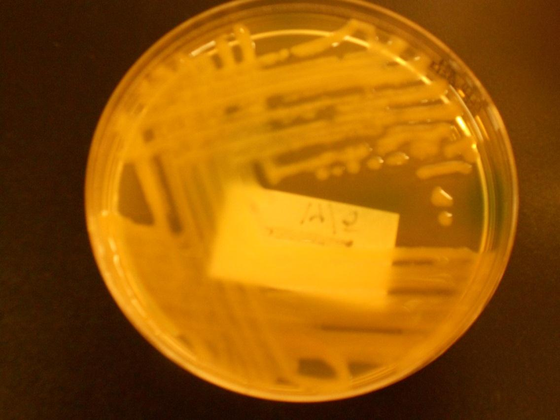 19 4.2.2 Klebsiella-suku Klebsiella-suku kuuluu gramnegatiivisiin anaerobisiin sauvabakteereihin.