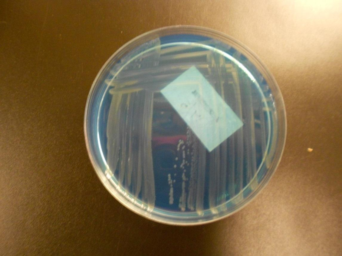 20 4.2.3 Pseudomonas-suku Pseudomonaksista tärkein on P. aeruginosa. Se on aerobisissa oloissa viihtyvä bakteeri, mutta pystyy kasvamaan myös anaerobisissa oloissa, mikäli olosuhteet ovat otolliset.