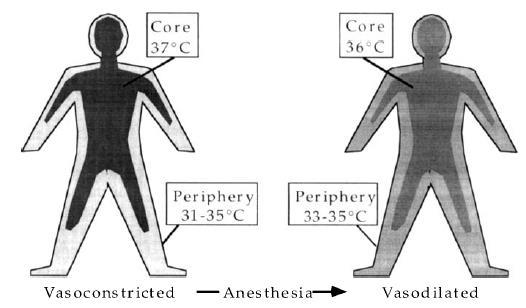 Sessler DI. Temperature monitoring. Anesthesia, 4th edition.