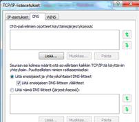 Merkitse valituiksi seuraavat kohdat: Hae IP-osoite automaattisesti Hae DNS-palvelinosoite automaattisesti 12.