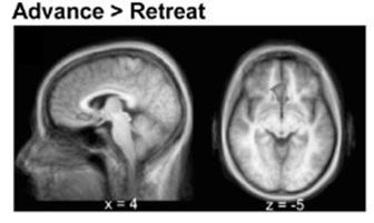 tumakkeen) aktivoituessa vahvistuu tiedonkulku cortexista hippocampukseen (paksu punainen nuoli) Amygdalaan tallennetun pelkomuiston esiinhaku (pelon