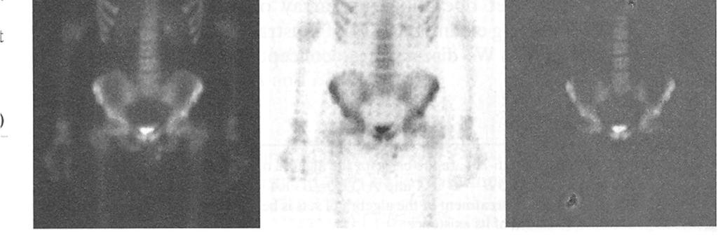 Binäärikuville on tavallista joukko-operaatioiden asemesta soveltaa loogisia operaattoreita OR, AND ja NOT, kun 1 tarkoittaa arvoa tosi ja 0 arvoa epätosi. (a) (b) (c) Kuva 2.27.