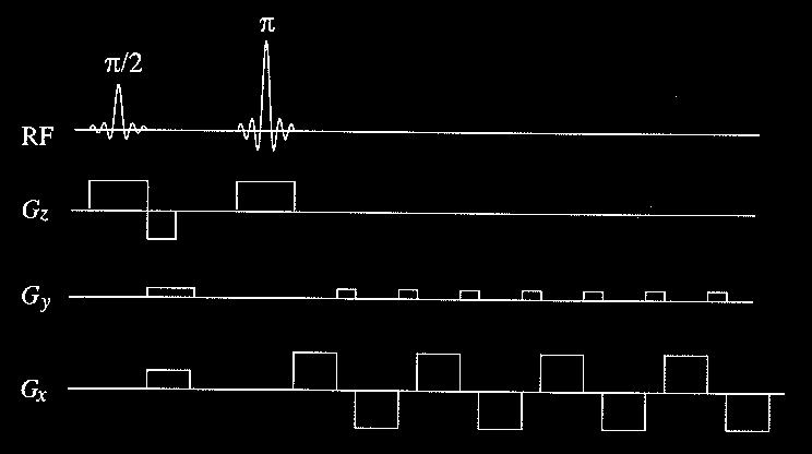 T2*-painotus EPI-kuvauksessa, teoria [1,4] Zigzag Keräys aloitetaan k-avaruuden keskeltä