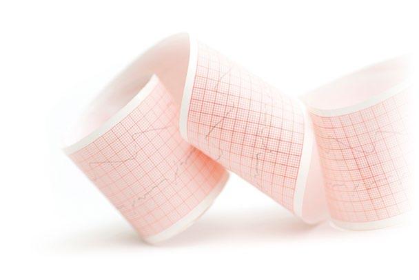 EKG-koulutukset EKG-koulutukset EKG:n tulkinta -koulutuskokonaisuus EKG:n käytössä voi kehittyä katsomalla yhä uusia EKG-käyriä ja harrastamalla sen tulkintaa.