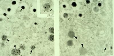 Neuropeptidit kuljetetaan