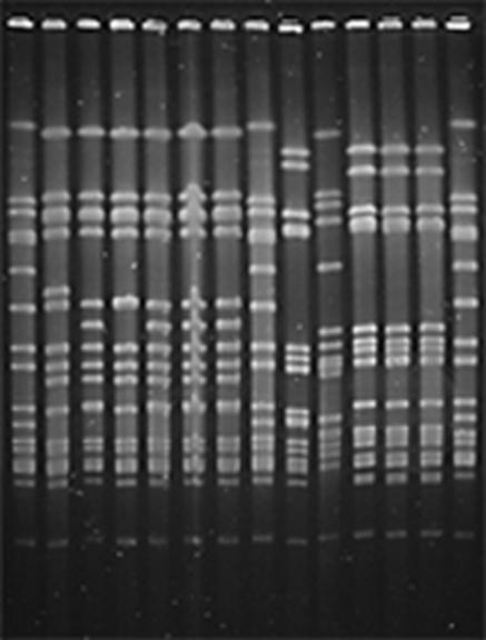 PFGE (Pulsed-Field Gel Electrophoresis) PFGE: Koko bakteerin genomi EI sekvensoida Genomisen DNA:n digestio