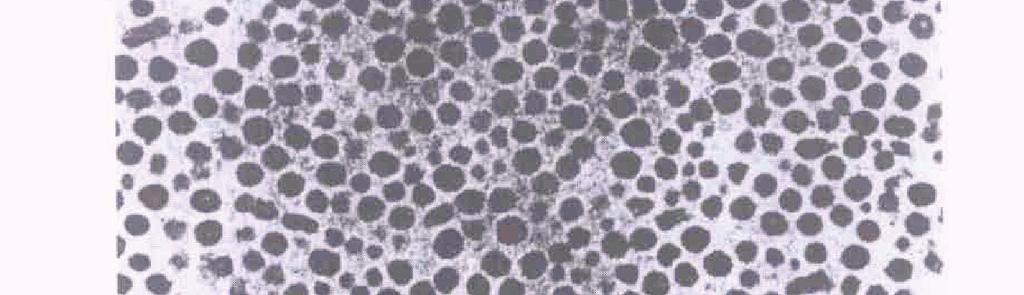 Spherical (micellar) self-assembled nanoscale structures of diblock copolymers If one block