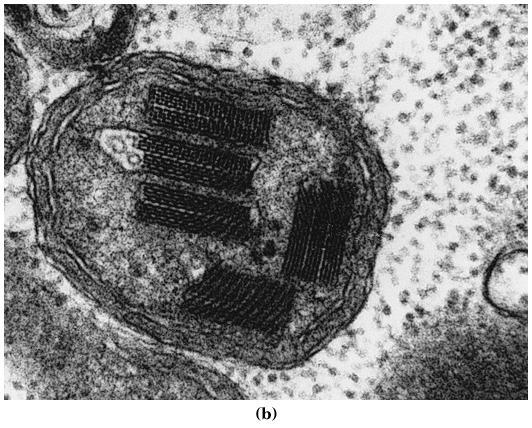 MERF-mitokondrio EM:ssä parkkipaikkakpl:t = kreatiinikinaasia; valomikroskoopissa repalesyyt (RRF), indikoivat mitokondrioiden
