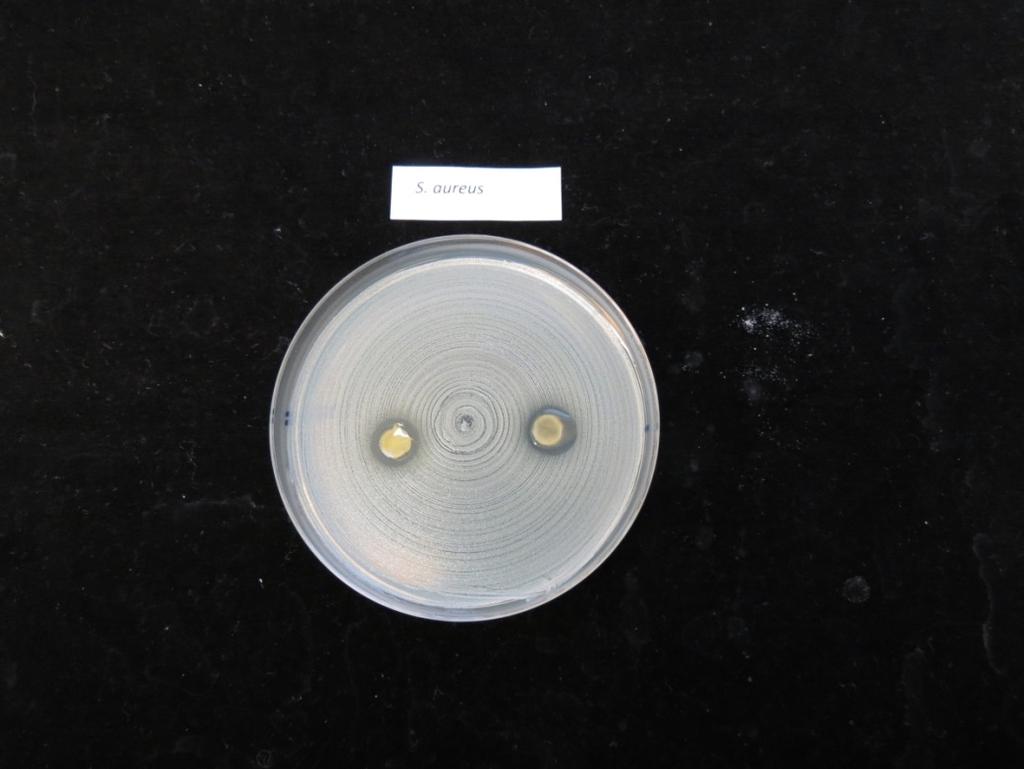 3. Tulokset Mikrobikasvatusmaljoilla havaittiin estokehä seuraavilla mikrobeilla: Staphylococcus aureus (Kuva 1.) Staphylococcus epidermidis (Kuva 2.) Streptococcus pyogenes (Kuva 3.) Kuva 1.