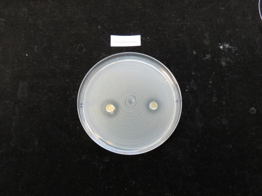 Kuva 2. Staphylococcus epidermidis bakteerin kasvun (harmaa, tasainen massa maljalla) estyminen pihka / kasvisöljyseoksen läheisyydessä.