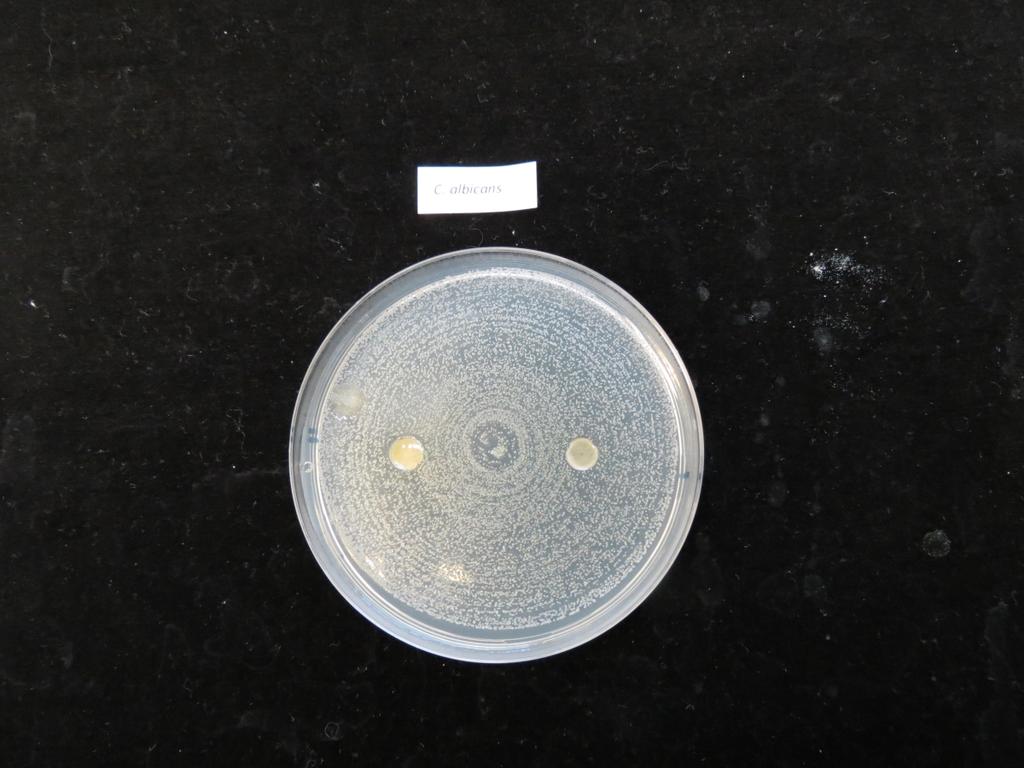 Kuva 5. Pseudomonas aeruginosa bakteerin kasvu (harmaa, tasainen massa maljalla) pihka / kasvisöljyseoksen läheisyydessä.