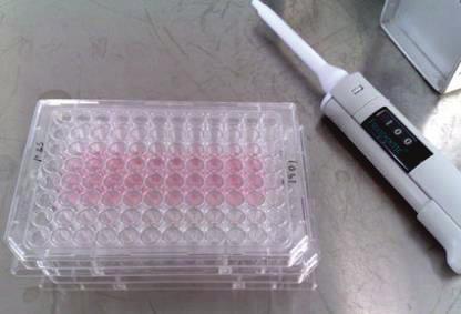 fenolit, FRAP, ORAC H2O2