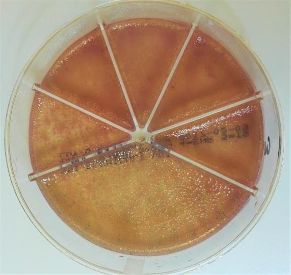 31 E. coli peittää ne osittain alleen. Tämän takia myös antibioottiherkkyys kokkikasvusta on hankala lukea maljalta.