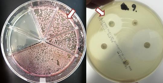 37 Kuvio 22. E. coli näkyy Amoksisilliini/klavulaanihapolle resistenttinä Flexicult Vet -maljalla ja herkkänä Mueller-Hintonilla.