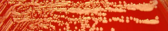 (Staphylococcus warneri) 1 2