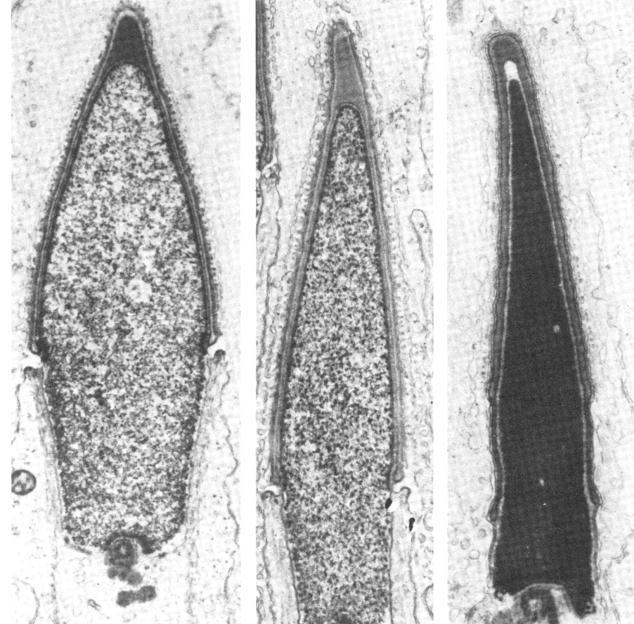 Tuman hienorakenne NL = Nucleolus on