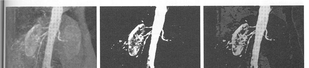 Kuva 3.8. (a) Muunnos korostaa intensiteettialuetta [A,B] ja vähentää kaikkia muita alemmalle tasolle.