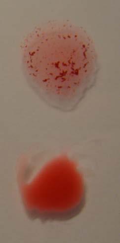 Pasturex TM Staph